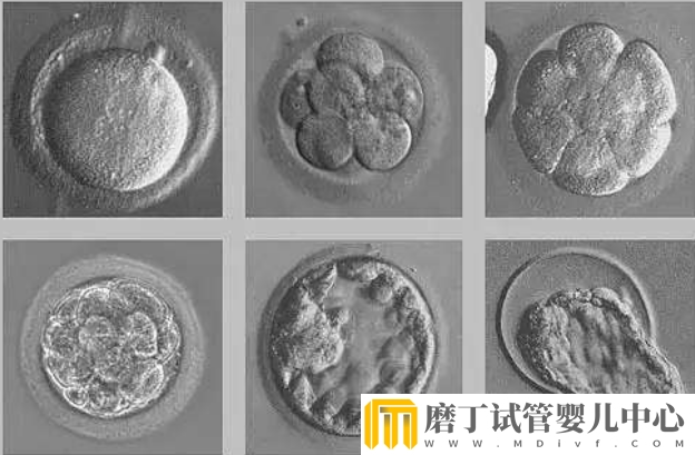 冻胚移植后1-14天变化情况，根据图片可清楚知道胚胎的变化(图5)
