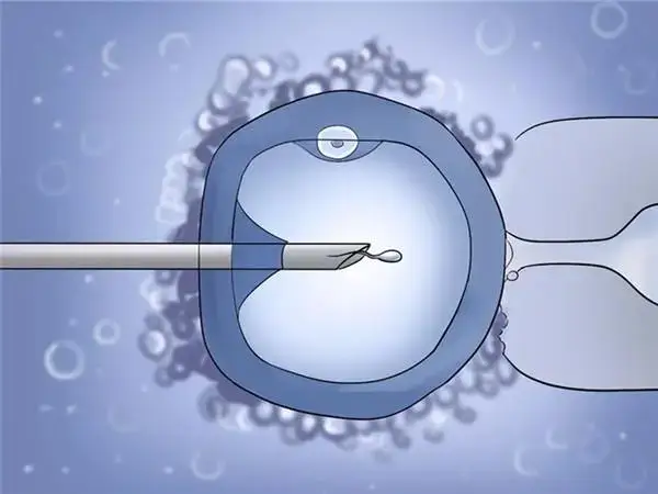 试管婴儿促排后不取卵会怎样(图1)